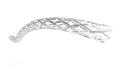 stent 11 .136.png